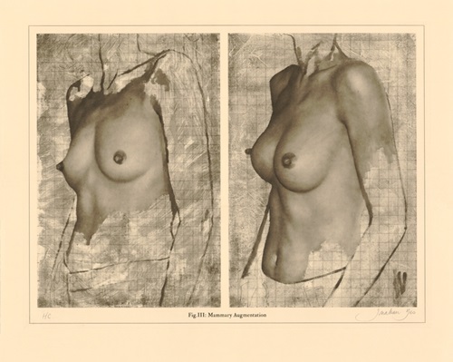 MCH_Artworks_ARTW000016054.jpg